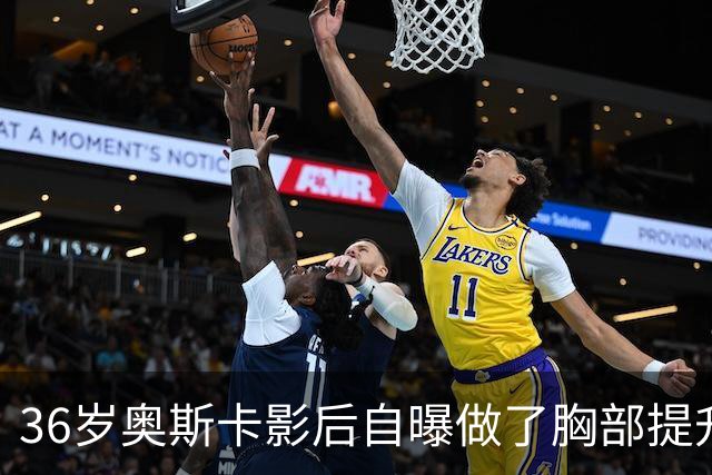36岁奥斯卡影后自曝做了胸部提升，推婴儿车出街被拍